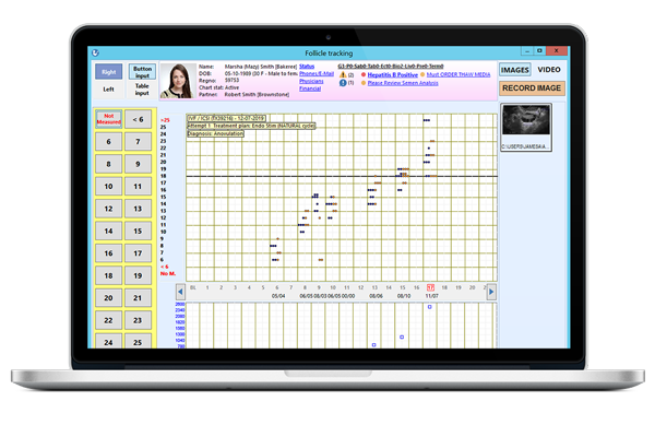Ultrasound integration Ultrasound integration